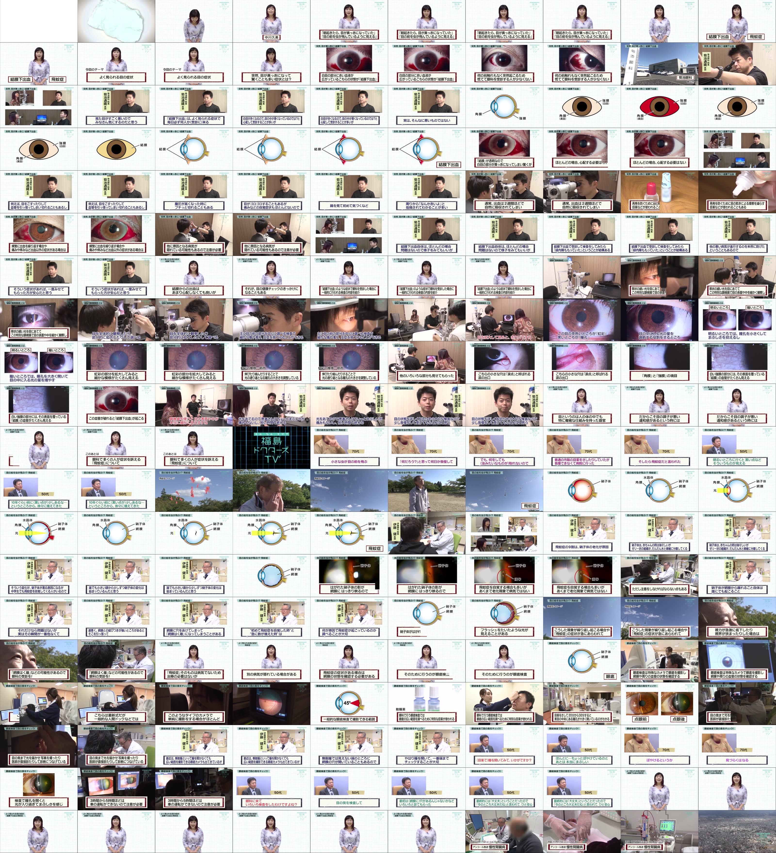 よく見られる目の症状 結膜下出血 飛蚊症 福島ドクターズtv 福島中央テレビ